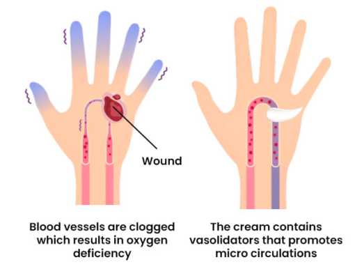 FLYCARE™ Diabetic Wounds Healing Ointment