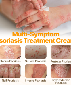 FLYCARE™ Psoriasis Anti-Bacterial Cream