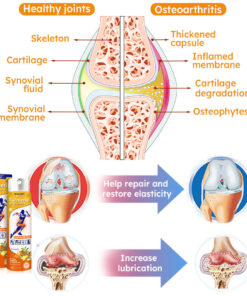 Furzero™ Turmeric Arthritis Spray