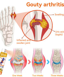 Furzero™ Turmeric Arthritis Spray