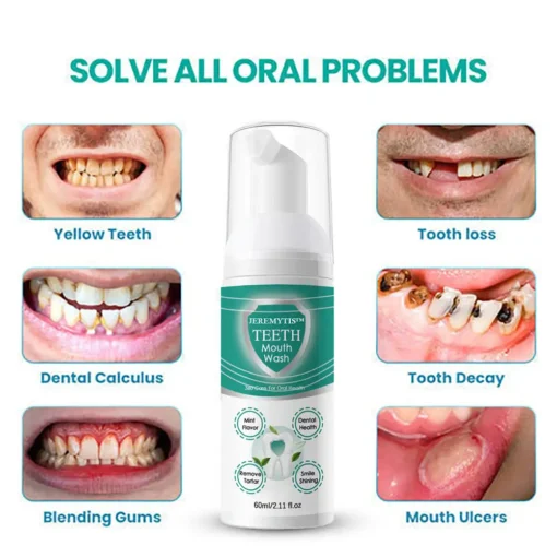 JEREMYTIS™ NEW TEETH Mouthwash - Solve all Oral Problems