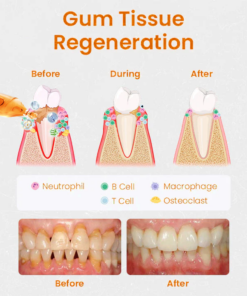 Lovilds™ Gum Repair Treatment Ampoules