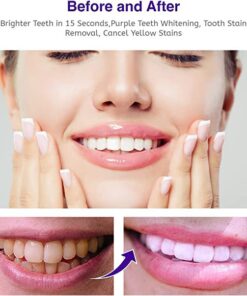 Lovilds™ Whitening Purple Serum Toothpaste