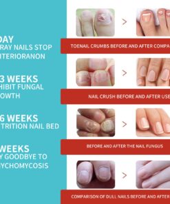 Nail Care Night Patches