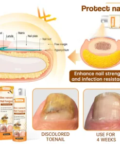Ourlyard™ Bee Venom Nail Fungus Spray