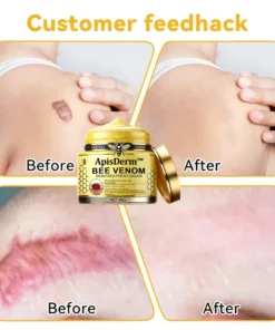 ApisDerm™ Bee Venom Skin Treatment Cream