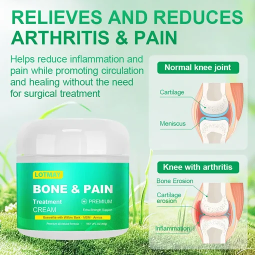 Lotmay® Boswellia Bone&Pain Treatment Cream