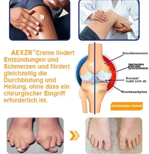 AEXZR™ Bienengift-Schmerzlinderungs Knochenheilungs Creme