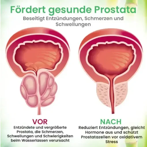 AEXZR™ Detox Prostata-Pflaster – Geheimnis jugendlicher Haut