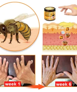 Croaie™ Bee Venom & Turmeric Joint and Bone Pain Relief Cream