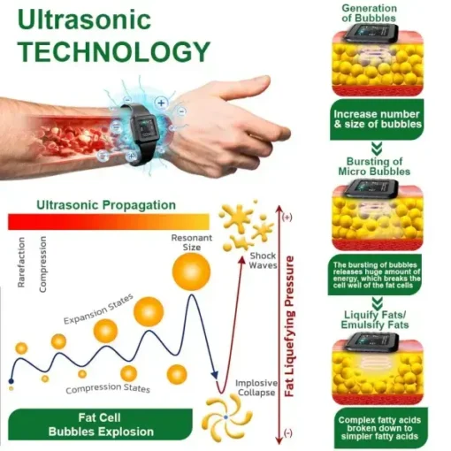 DIYSTAR™ Ultrasonic Fat Blasting and Detoxing Wristband