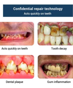 DOCTIA™ TeethRestoration Toothpaste Gel