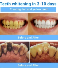 Doctia™ Teeth Restoration Mineral Powder