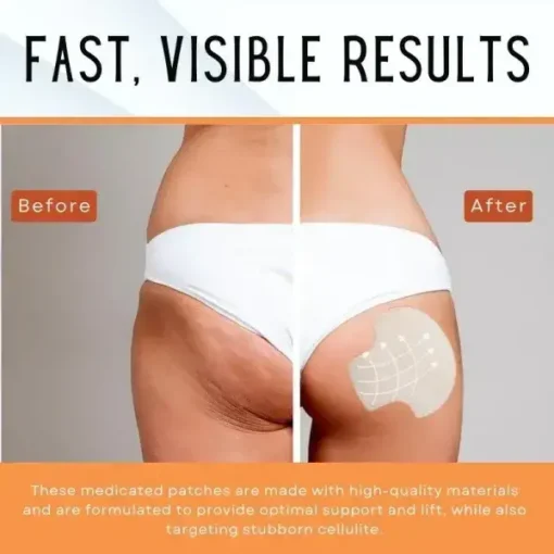 Fivfivgo™ Butt-Lift Shaping Pads