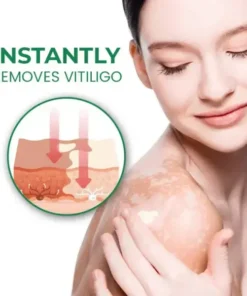 Fivfivgo™ VitiligoFix Revitalize Elixir