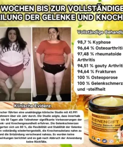 Furzero™ Bienengift- und Kurkuma-Gelenk- und Knochenschmerzlinderungscreme