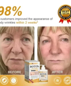 Furzero™ Botox Bee Venom Wrinkle