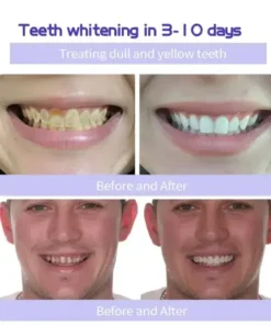 GarageLine™ Teeth Restoration Mineral Powder