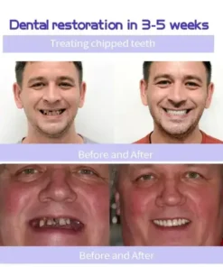 GarageLine™ Teeth Restoration Mineral Powder