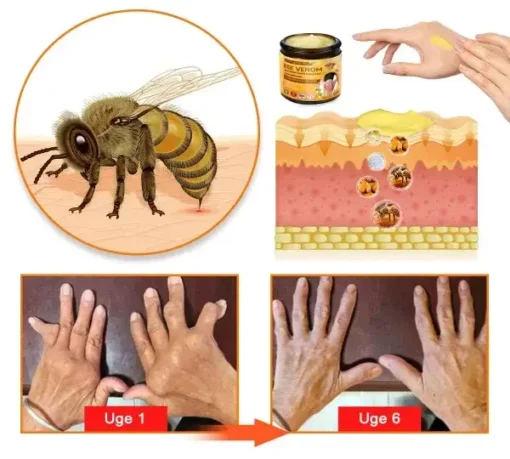 HONXI™ Bee Venom & Gurkemeje-creme til lindring af led-og knoglesmerter