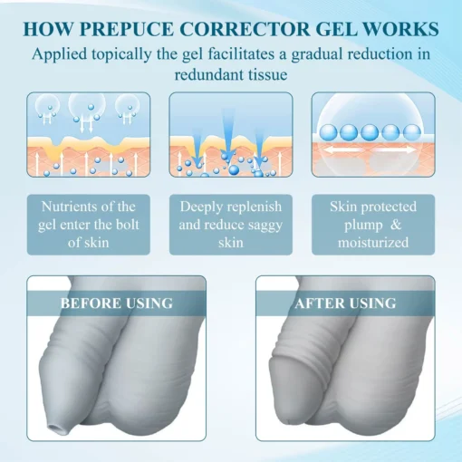 MaleGuard™ Redundant PrepuceCorrector Gel