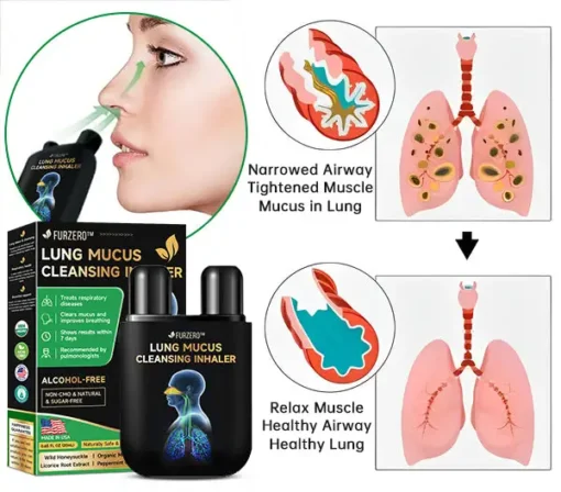 Ourlyard™ Lung Mucus Cleansing Spray