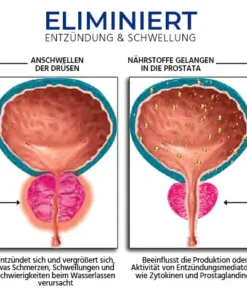 Oveallgo™ BeeProsta BIO-ACTIVE Nasenspray für die Prostatagesundheit