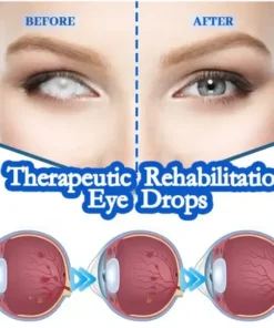 THONESR™ Vision recovery eye drops