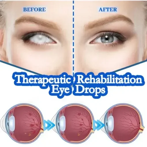 THONESR™ Vision recovery eye drops