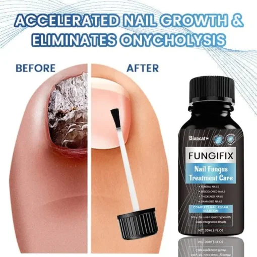 Biancat™ FungiFix Nail Fungus Treatment Care Fluid - Image 5