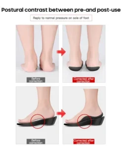 Flat Foot Orthopedic Insoles