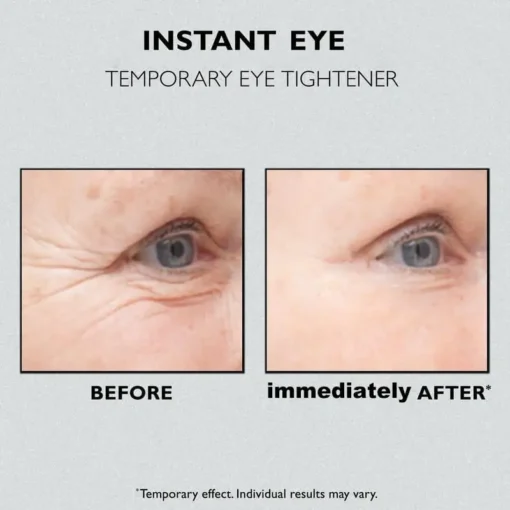 Lovilds™ Instant Eye Temporary Eye Tightener - Image 4