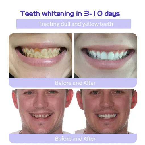 Lovilds® Teeth Restoration Mineral Powder - Image 10