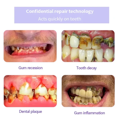 Lovilds® Teeth Restoration Mineral Powder - Image 8