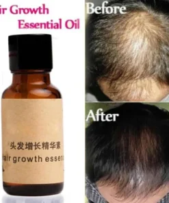 Organic Hair Growth Essence