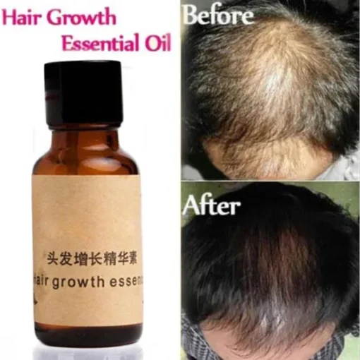 Organic Hair Growth Essence