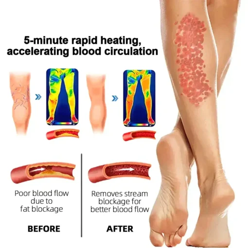 Paiduis™ Radiofrequency Herbal Thermal Knee Support - Image 10