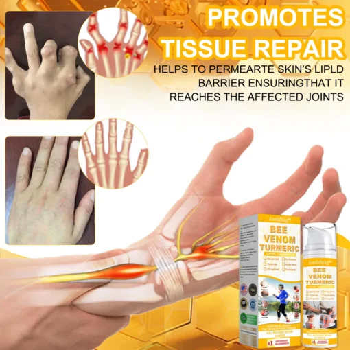 Lotmay™ Bee Venom & Turmeric Arthritis Treatment Gel - Image 13